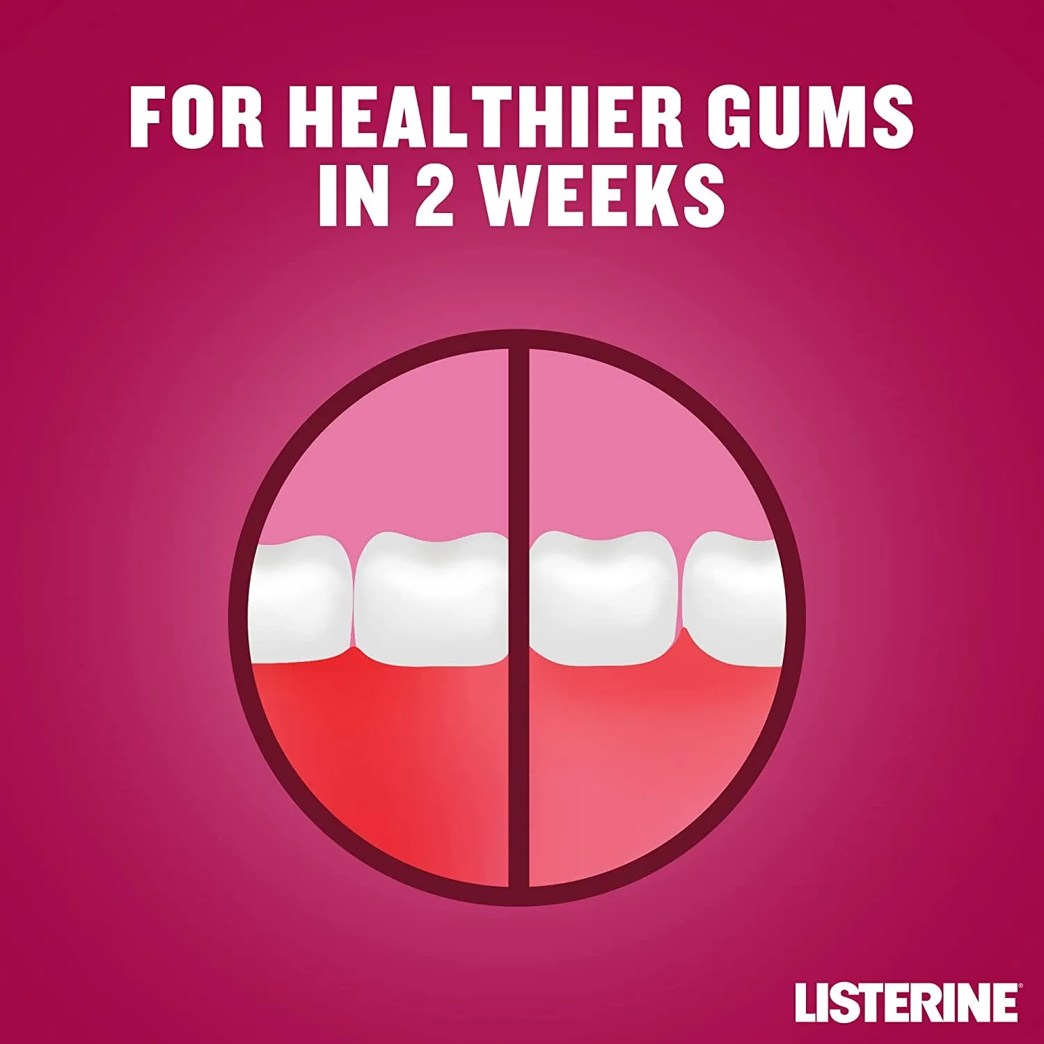 Advanced Defence Gum Treatment Mouthwash (500ml), Clinically Proven to treat Gum Disease for Healthier Gums in as Little as Two Weeks, Repels Plaque Germs to Treat and Prevent Gingivitis from Recurring