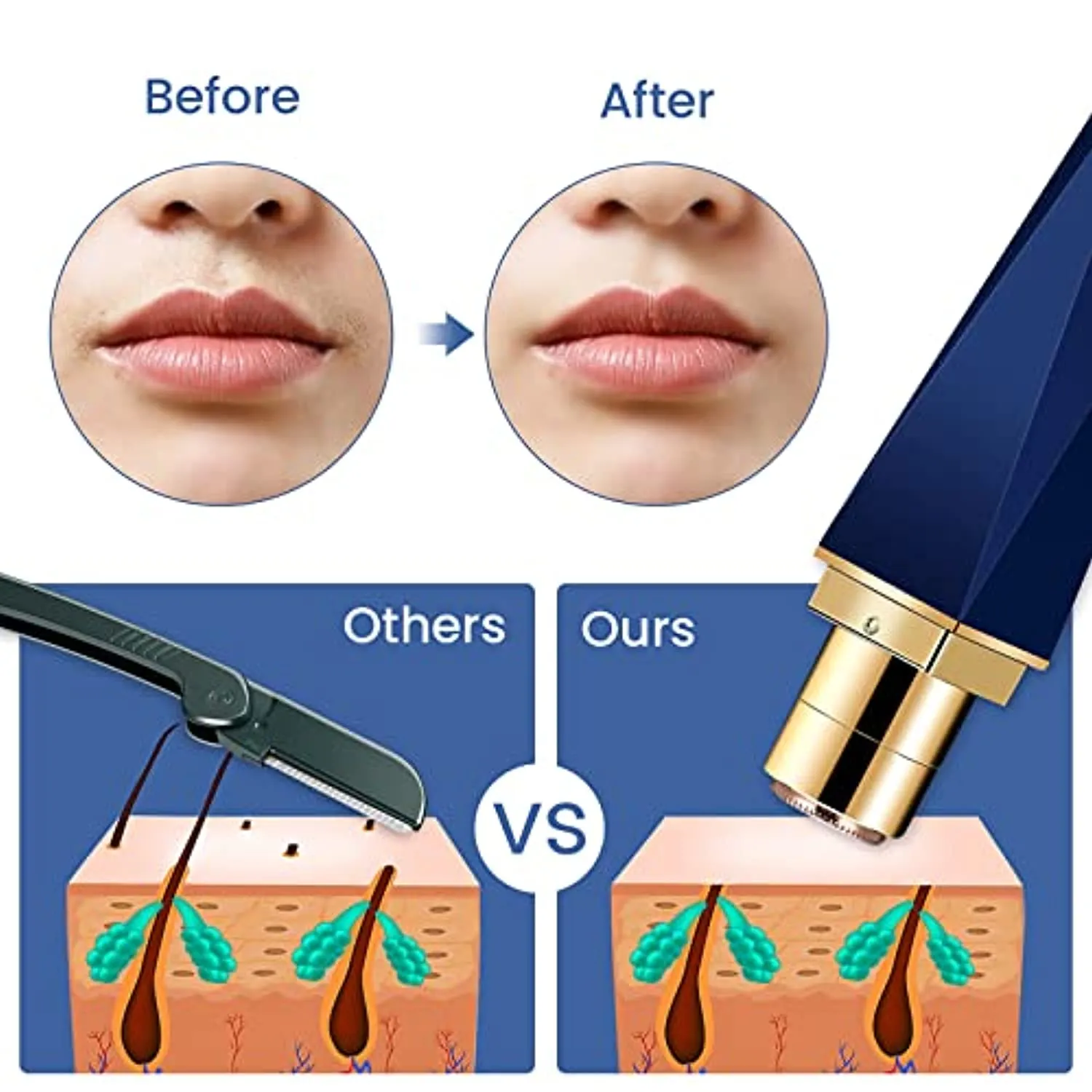 Facial Hair Remover for Women Mefor Lip Hair Remover USB Charge Light and Portable Flawless Hair Remover Gift for Women