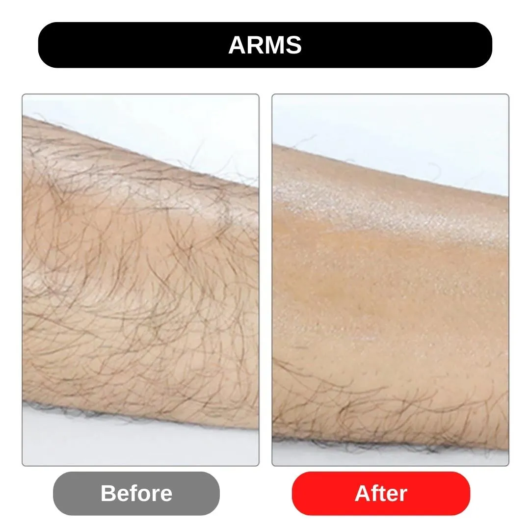 Hair Eraser Bar - Painless Hair Removal Tool