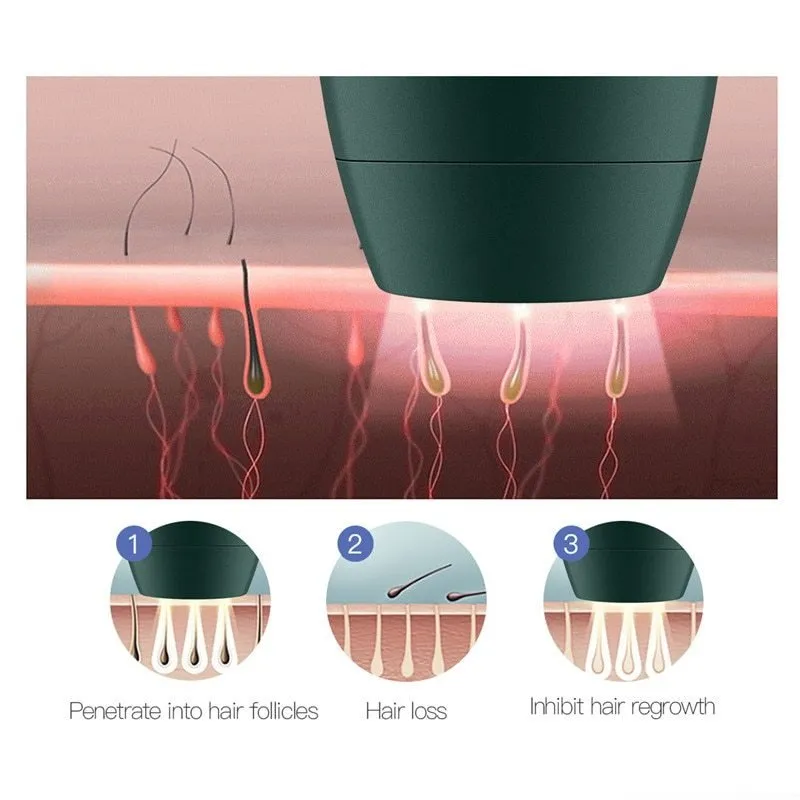 IPL Hair Removal Device For Comfortable Home Use