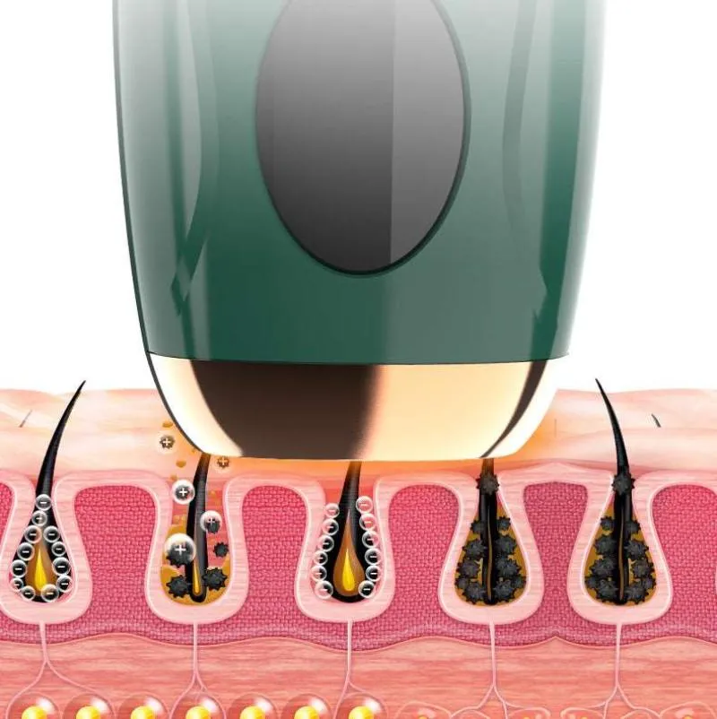 IPL Long-Lasting Hair Removal for Women and Men Remover Device for Whole Body