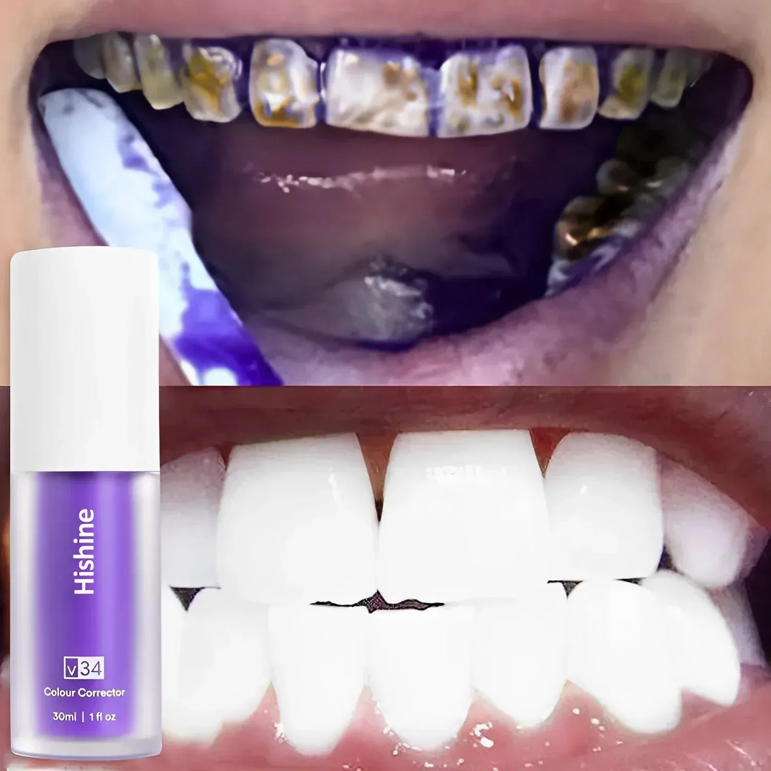 Oveallgo™ Pure Herbal Teeth Whitening Mousse