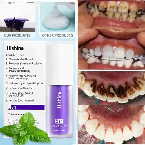 Oveallgo™ Pure Herbal Teeth Whitening Mousse