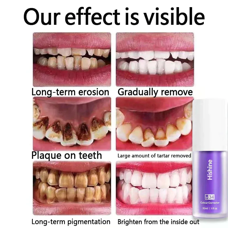 Oveallgo™ Pure Herbal Teeth Whitening Mousse