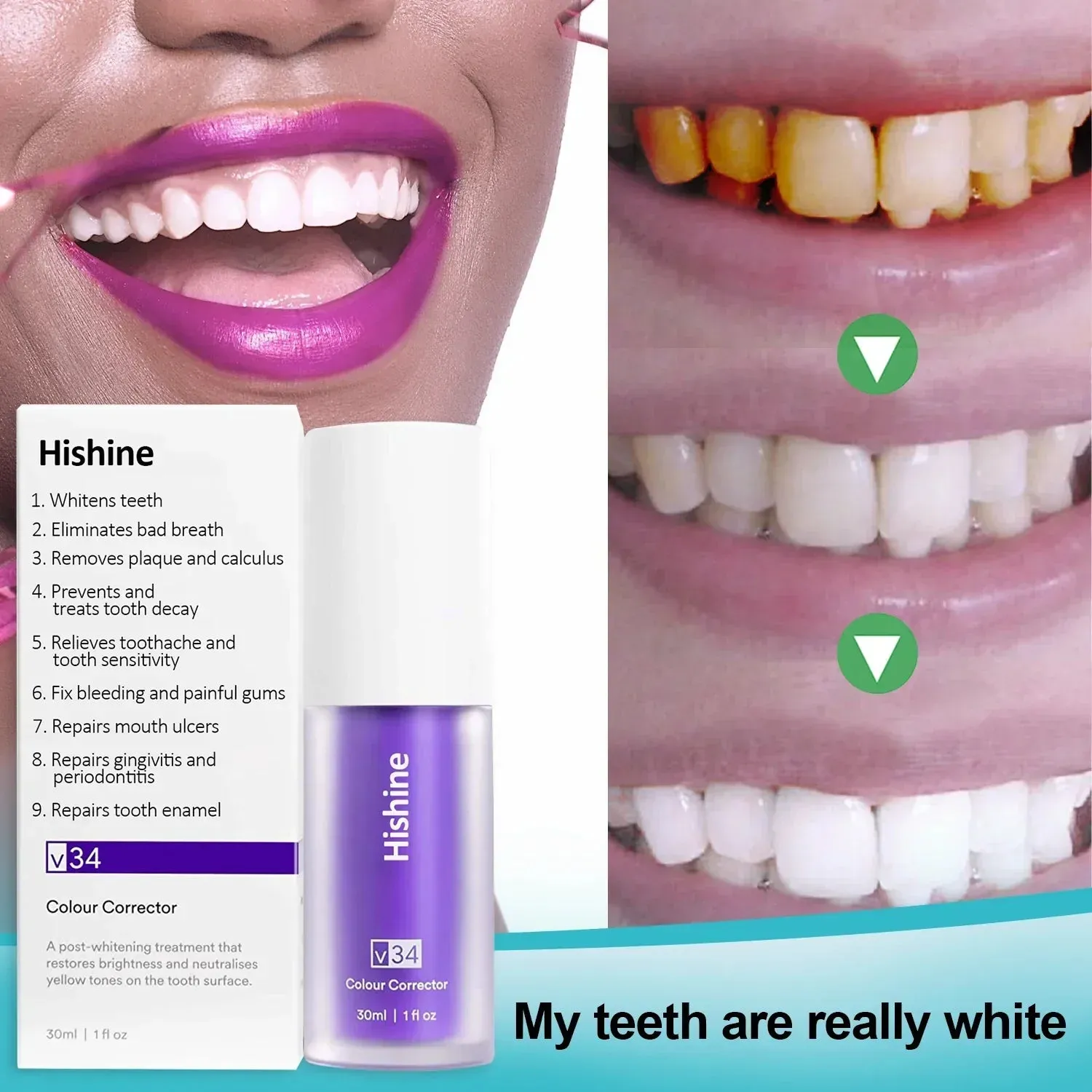 Oveallgo™ Pure Herbal Teeth Whitening Mousse