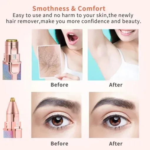 SmartMart® 2 in 1 Electric Face Hair Remover