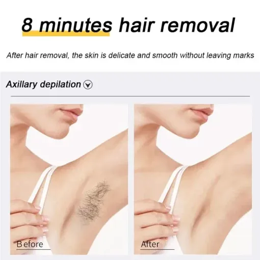 SmartMart®Ecrin Hair Removal Spray